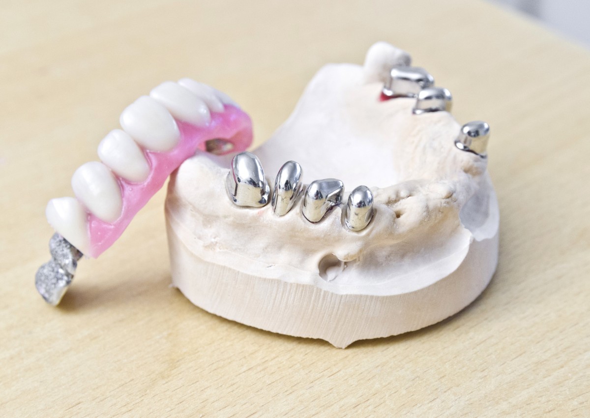Zahnarzt Praxis Paßlack - Zahnersatz-01